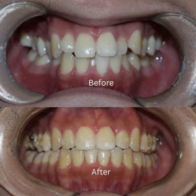 Transformation by Dr Sara Chu