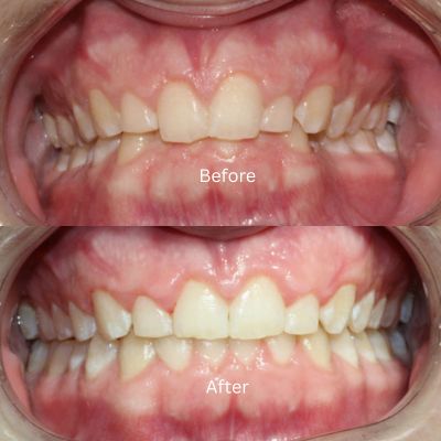 Transformation by Dr Sara Chu