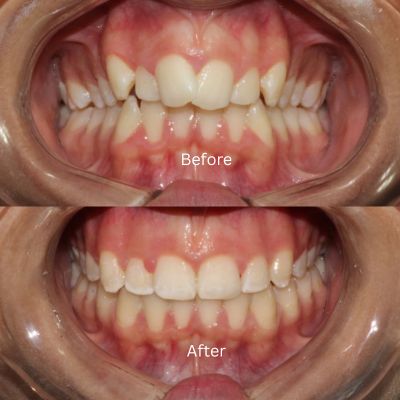 Transformation by Dr Sara Chu