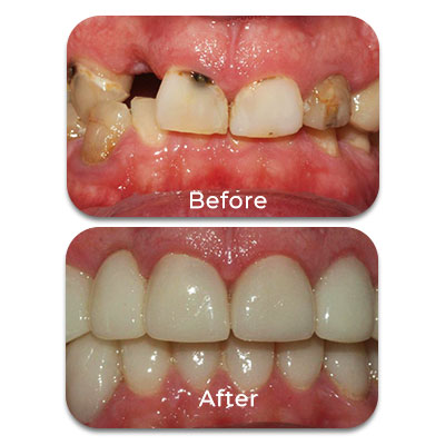 Transformation