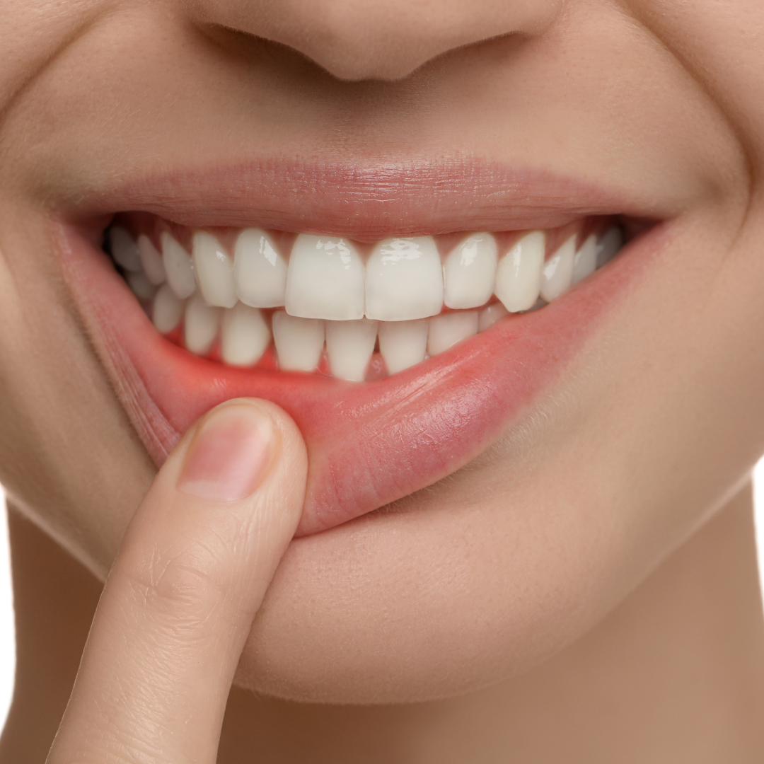 Gum Disease Treatment