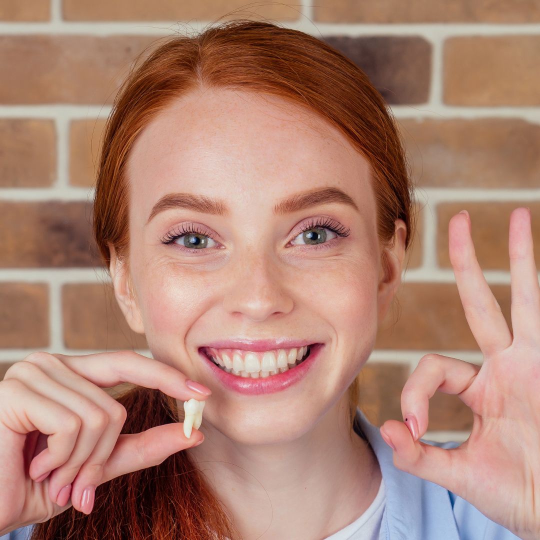 Wisdom teeth removal in Chatswood