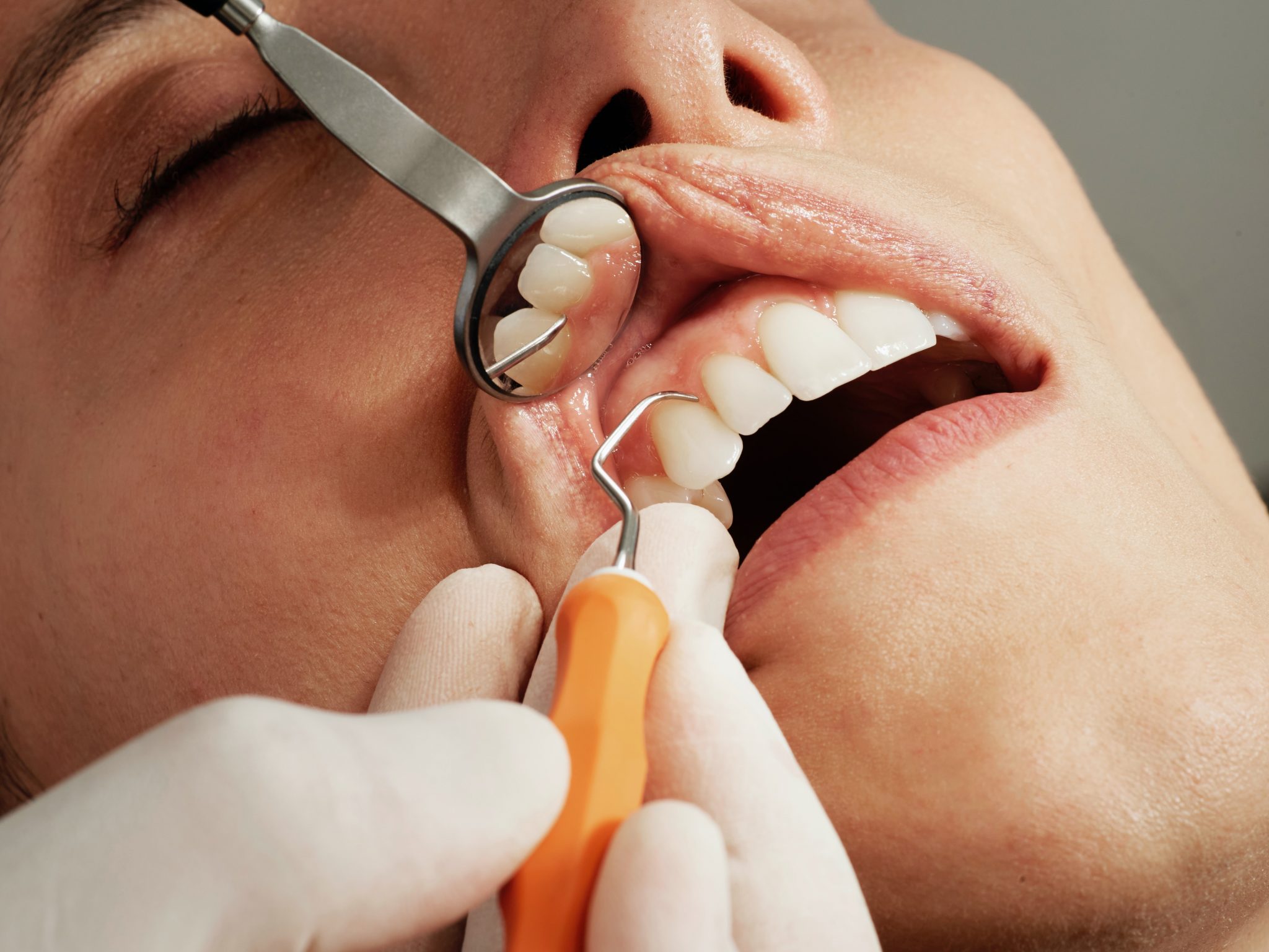 Managing Loose Teeth: Professional Solutions and When to Seek Help