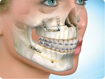 The Role of Oral and Maxillofacial Surgery in Modern Healthcare