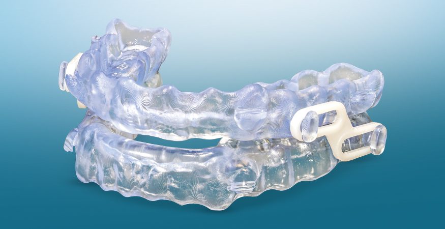 Why Choose Silent Nite Over CPAP?