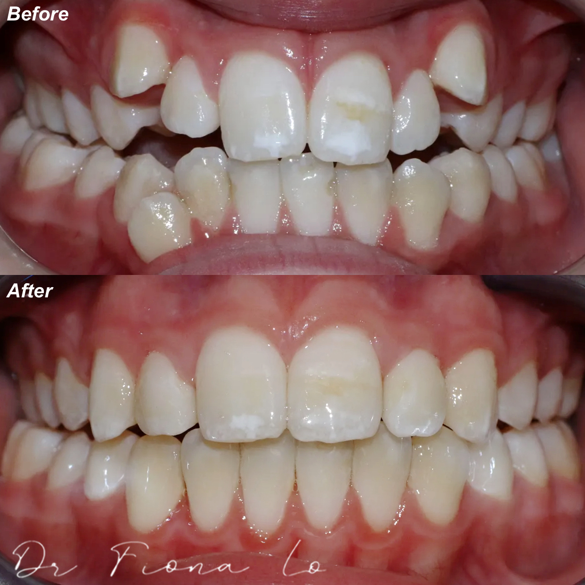 The True Benefits of Orthodontics