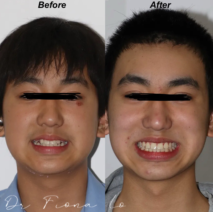 A Journey to a Confident Smile: The Power of Orthodontic Transformation