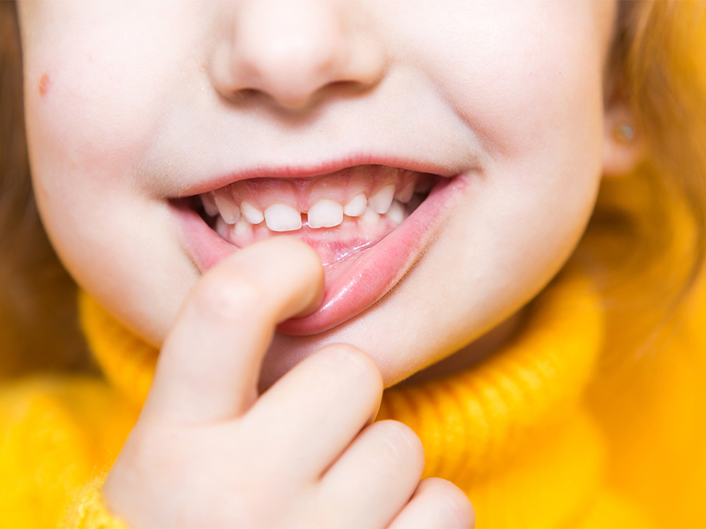 Why baby teeth matters