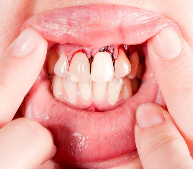 Dental Emergency