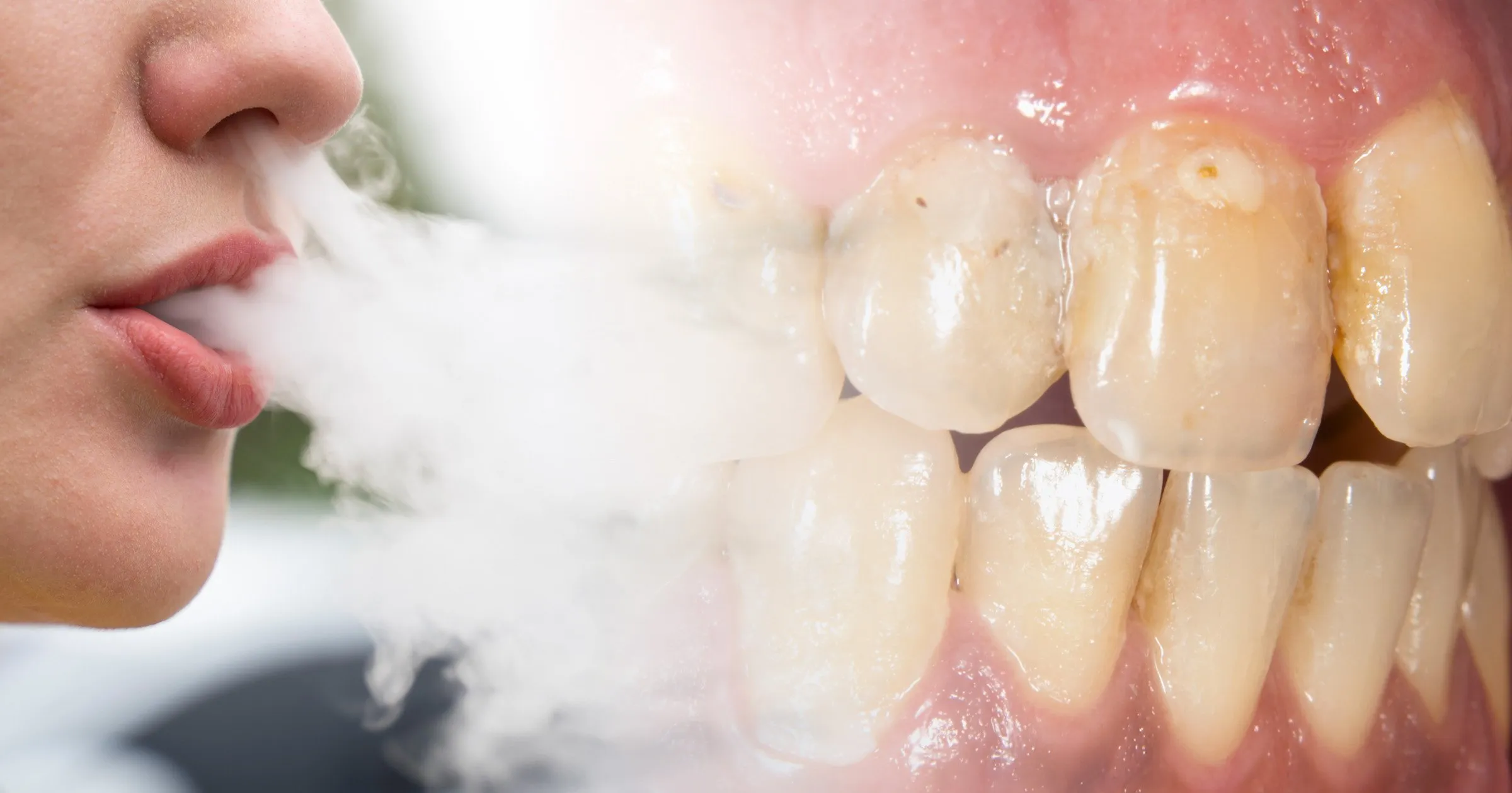Vaping and your Oral Health