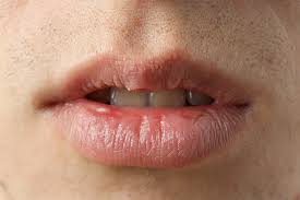 Are Your Medications Causing Cavities?