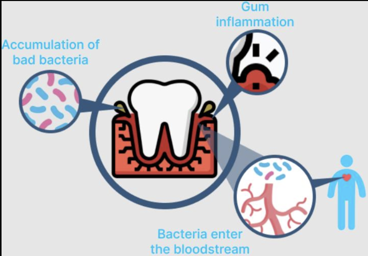 How Dental Health Affects Your Heart