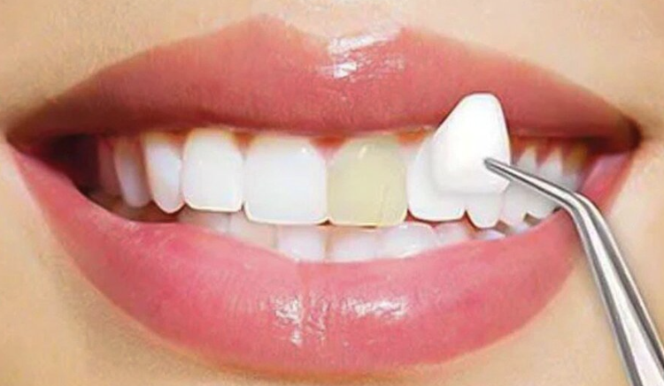 A Simple Way to Feel Better About Your Smile