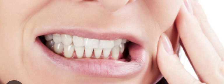 Teeth Grinding or Bruxism: Why It Happens 