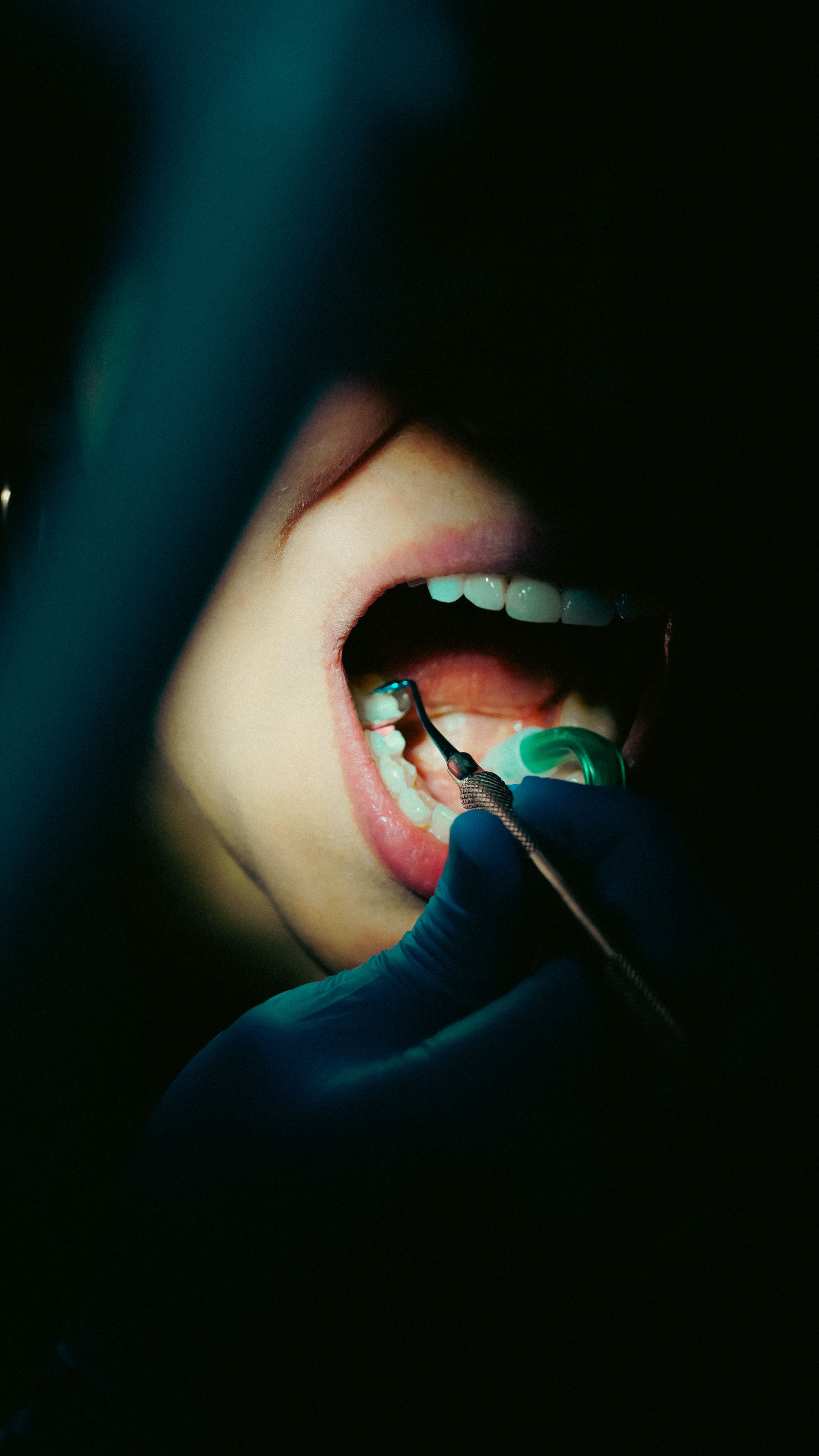 Stress and its effects on oral health